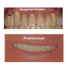 Provisorium