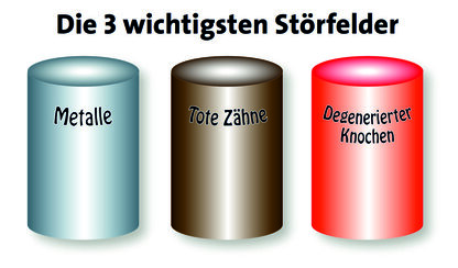 Metalle, Zähne, Störfelder